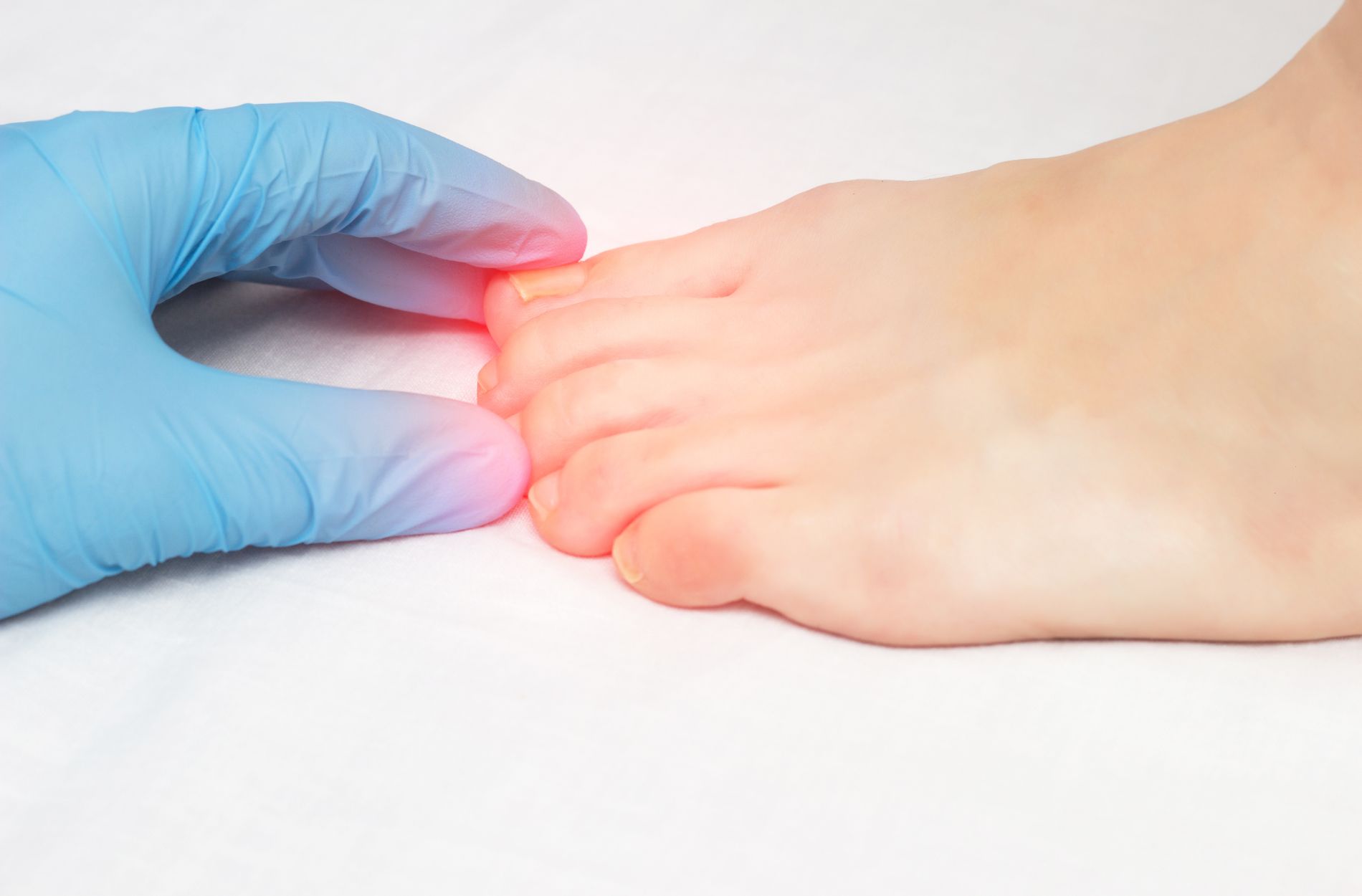 Expert Toenail Fungus Consultation and Advanced Treatment at The Foot and Ankle Clinic
